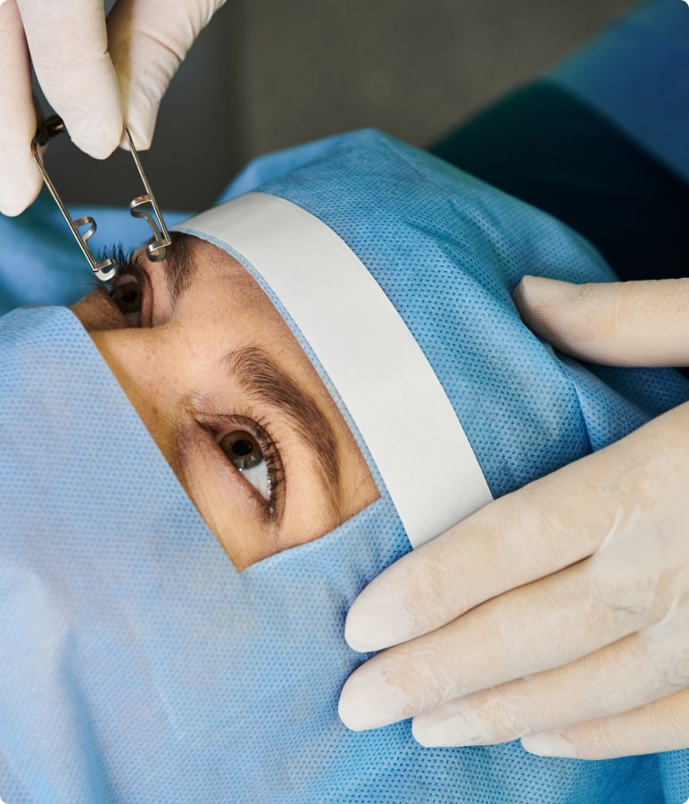 Nahaufnahme eines Auges während einer Prozedur. Person trägt blauen OP-Drape, Handschuh hält ein Werkzeug am Auge.