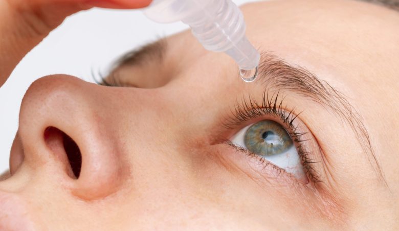 Nahaufnahme einer Person, die Augentropfen in ihr rechtes Auge eintropft; die Pipette wird oben gehalten, der Tropfen tritt gerade ins Auge ein.