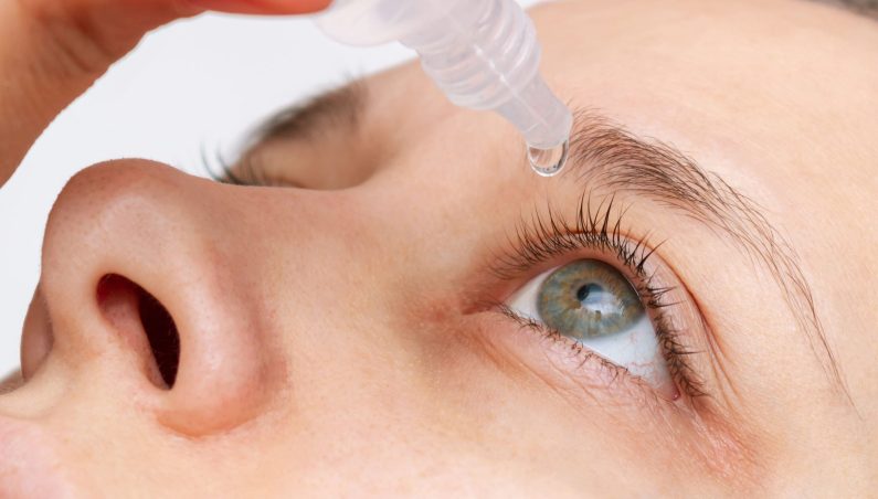 Nahaufnahme einer Person, die Augentropfen in ihr rechtes Auge eintropft; die Pipette wird oben gehalten, der Tropfen tritt gerade ins Auge ein.